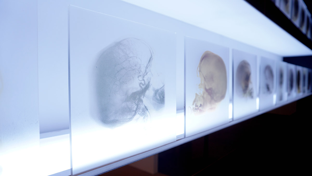 Exposição 70ºaniversário Prémio Nobel - Egas Moniz realizado pela Proeasy design